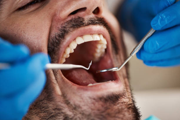 Best Broken or Cracked Tooth Emergency Dentist in East Ridge, TN